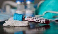 Число заболевших коронавирусом в Венгрии достигло 12