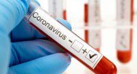 В двух соседних c Венгрией странах обнаружен коронавирус