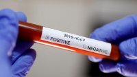 В Венгрии уже семь случаев заболевания коронавирусом